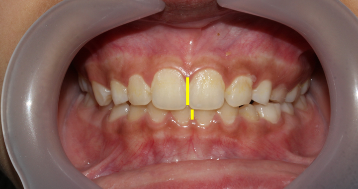 dents-selma